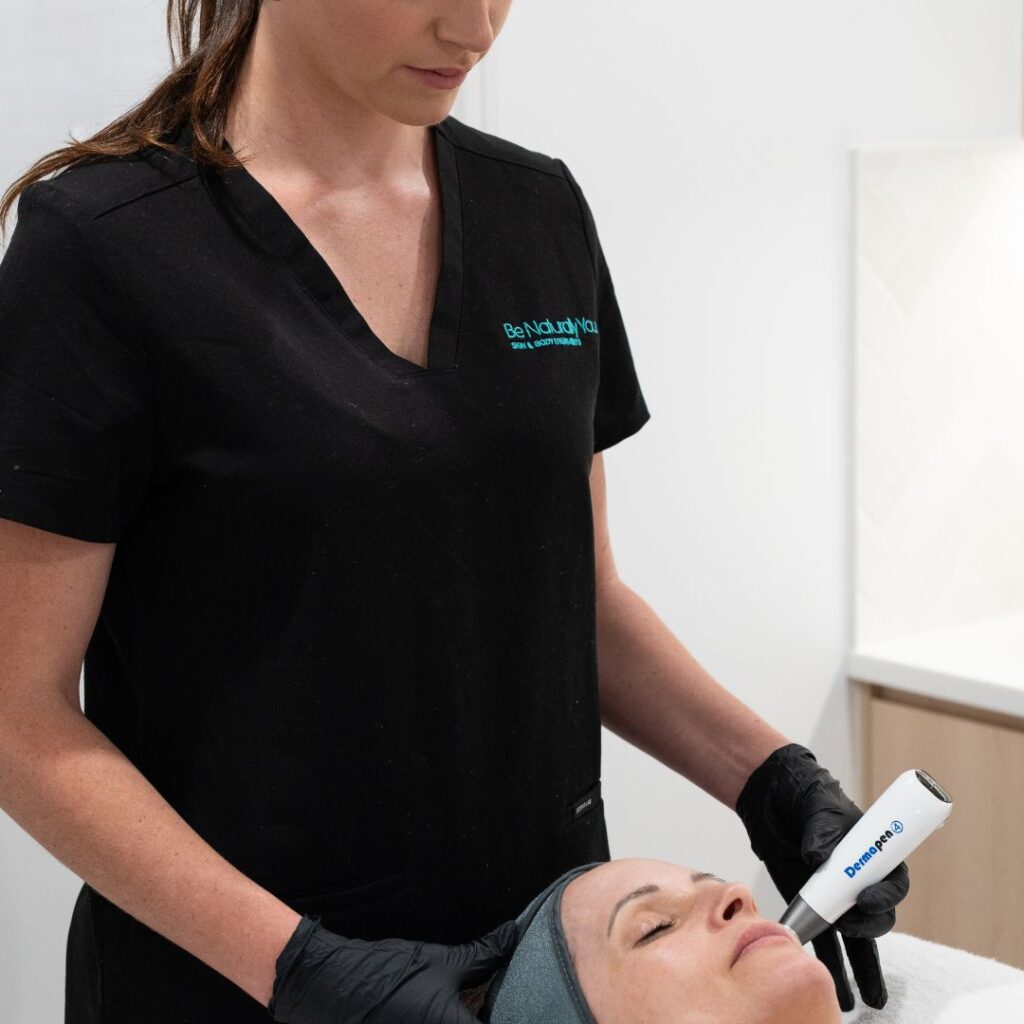 Pro Skin Needling