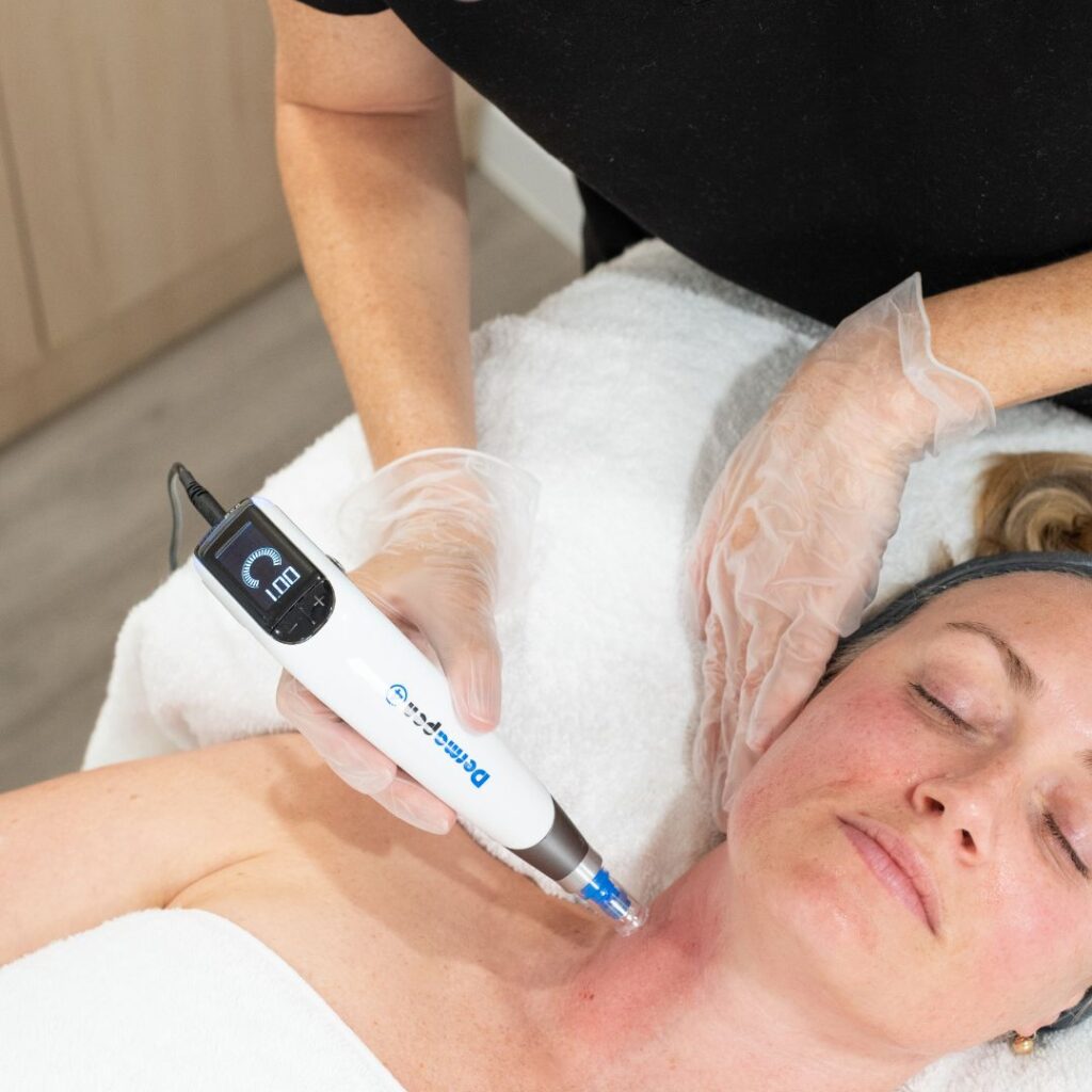woman receiving a Neck & Decolletage skin needling treatment