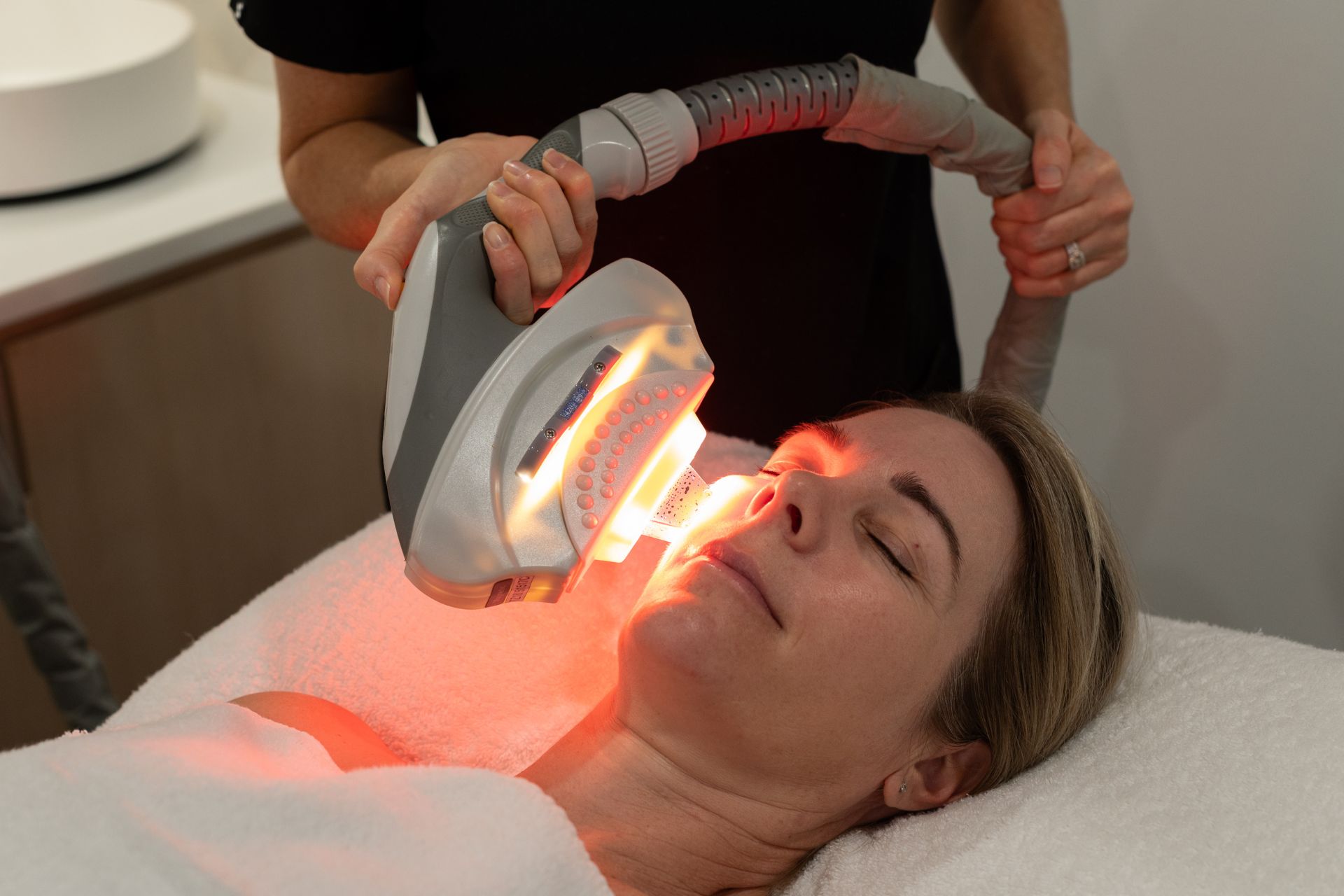 IPL treatment