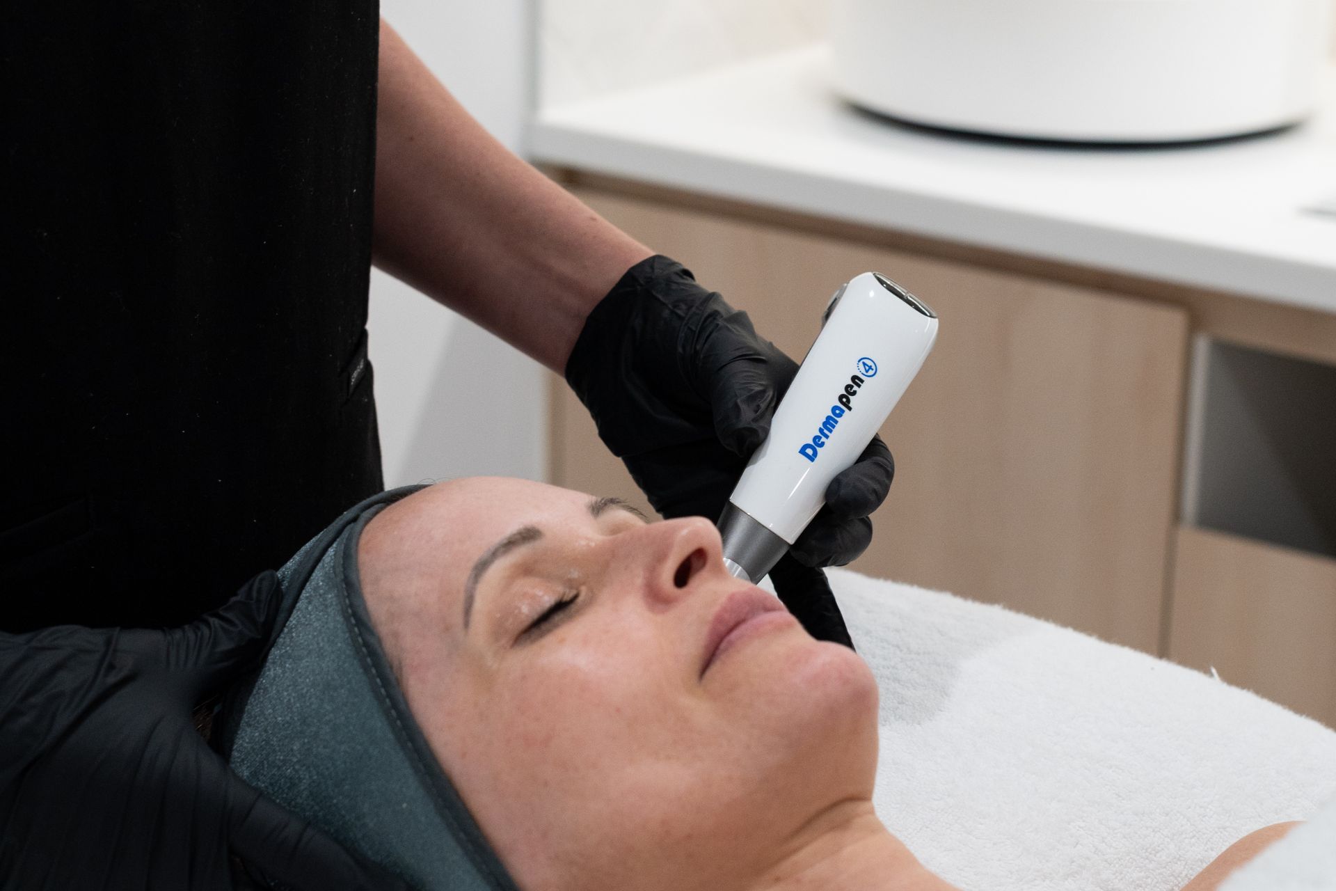 skin needling with dermapen